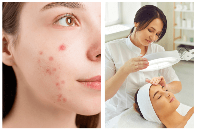 Dermal Fillers in Lucknow